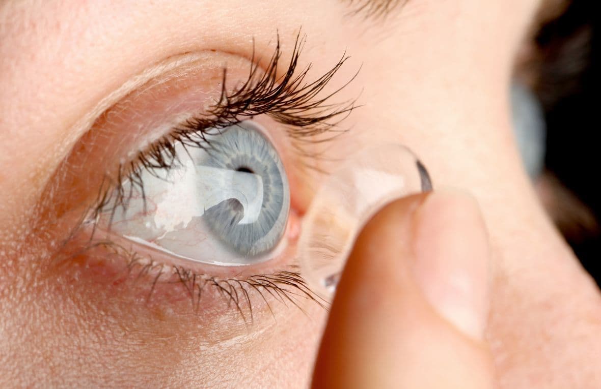 Contact Lenses & Lens Fitting